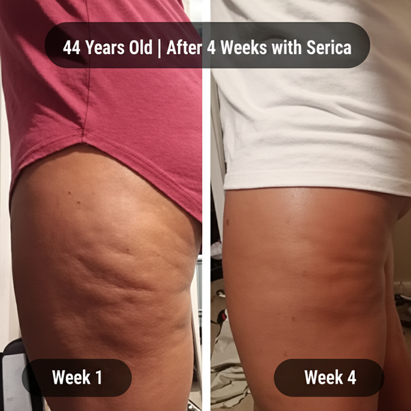 44 Years Old - High Quality Week 1 & Week 4