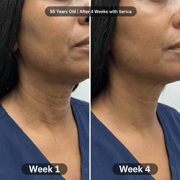 55 Years Old - Week 1 & Week 4 Centered