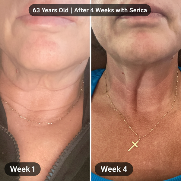 63 Years Old - Week 1 Left, Week 4 Right